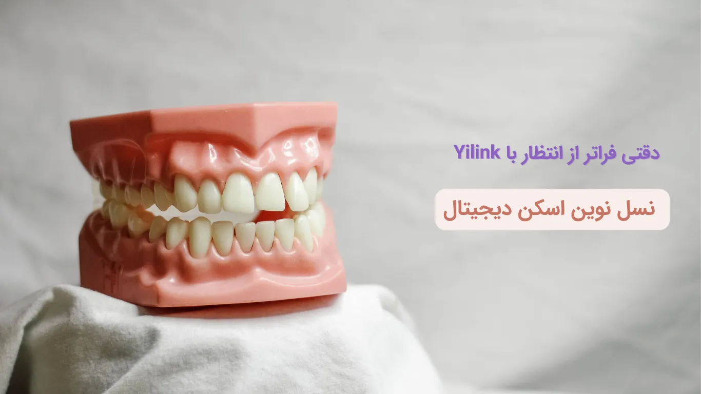 بنر کامل اسکن دیجیتال دندانپزشکی Yilink
